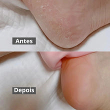 Carregar imagem no visualizador da galeria, Meias de Silicone Hidratantes Par 2 Pçs
